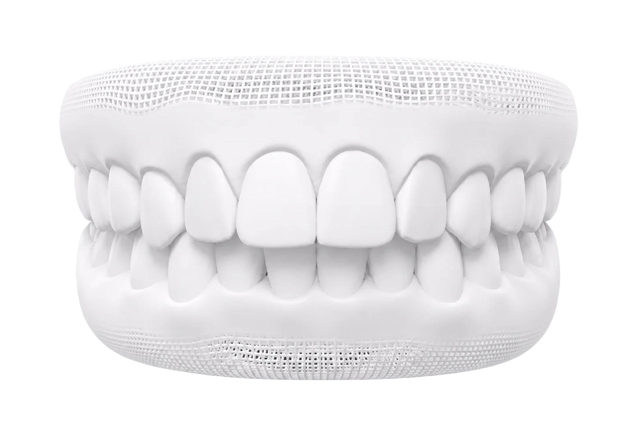 3D-Modell eines Überbisses mit deutlich vorstehenden oberen Frontzähnen.