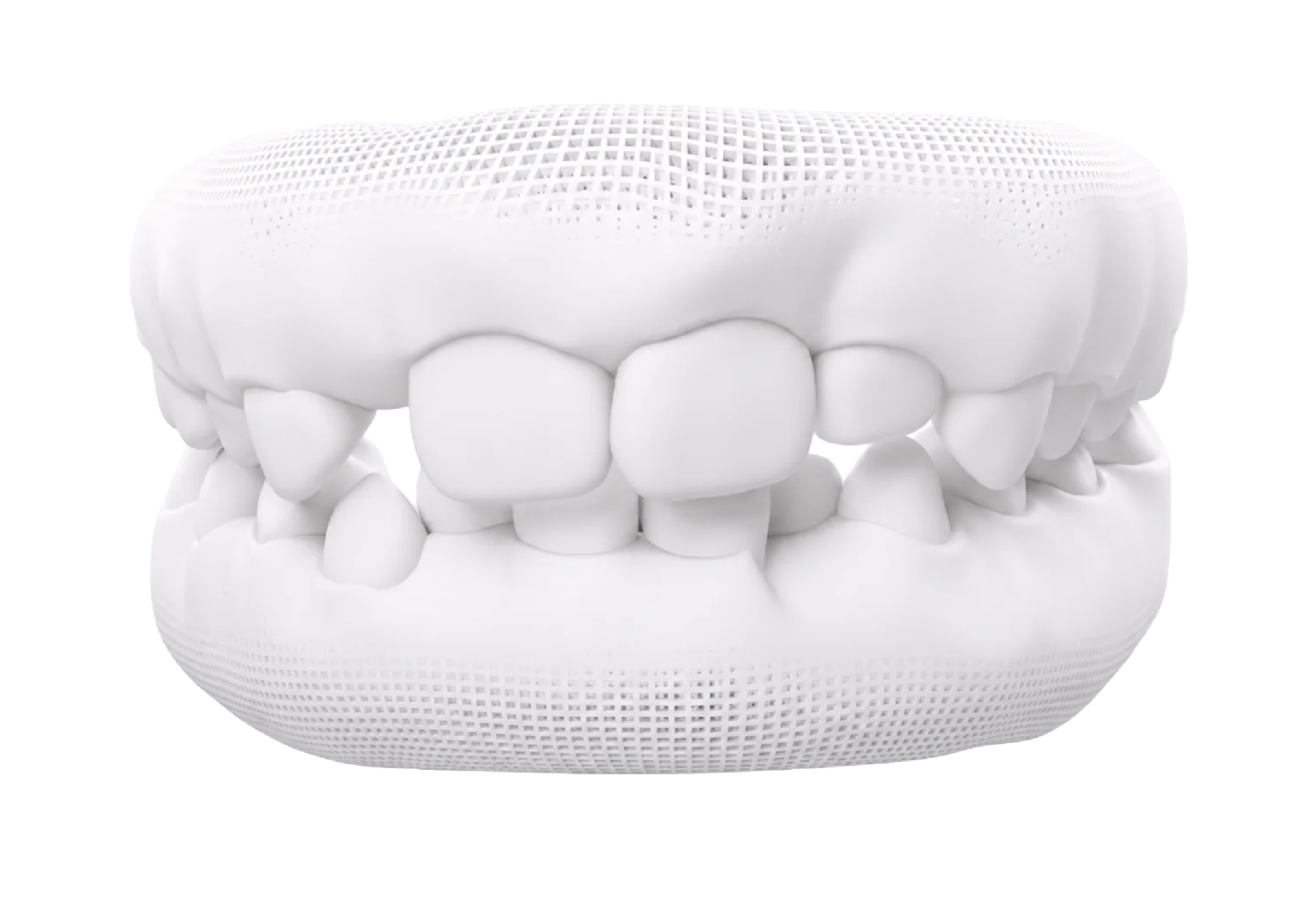 3D-Modell eines Wechselgebisses mit Milchzähnen und bereits durchbrechenden bleibenden Zähnen.