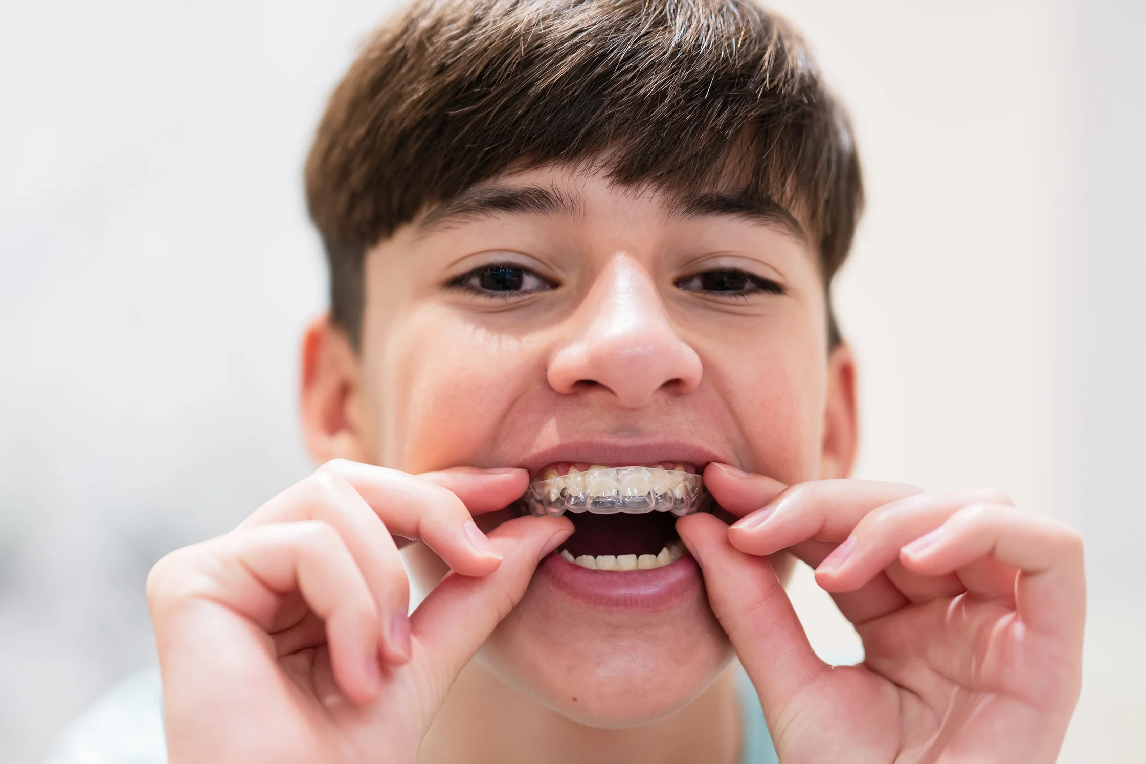 Junge mit Aligner-Aligner für Kinder bei Grünwald smiles